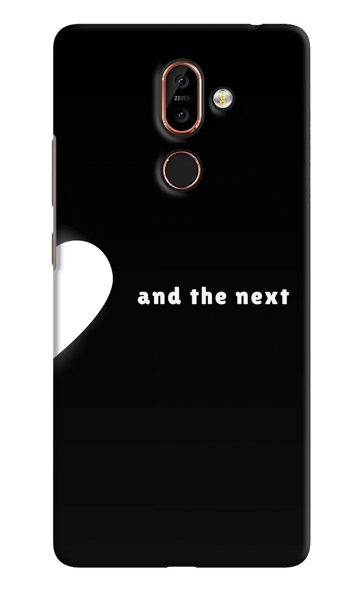 Next World Nokia 7 Plus Back Cover - Next World Nokia 7 Plus Back Cover Next World Nokia 7 Plus Back Cover