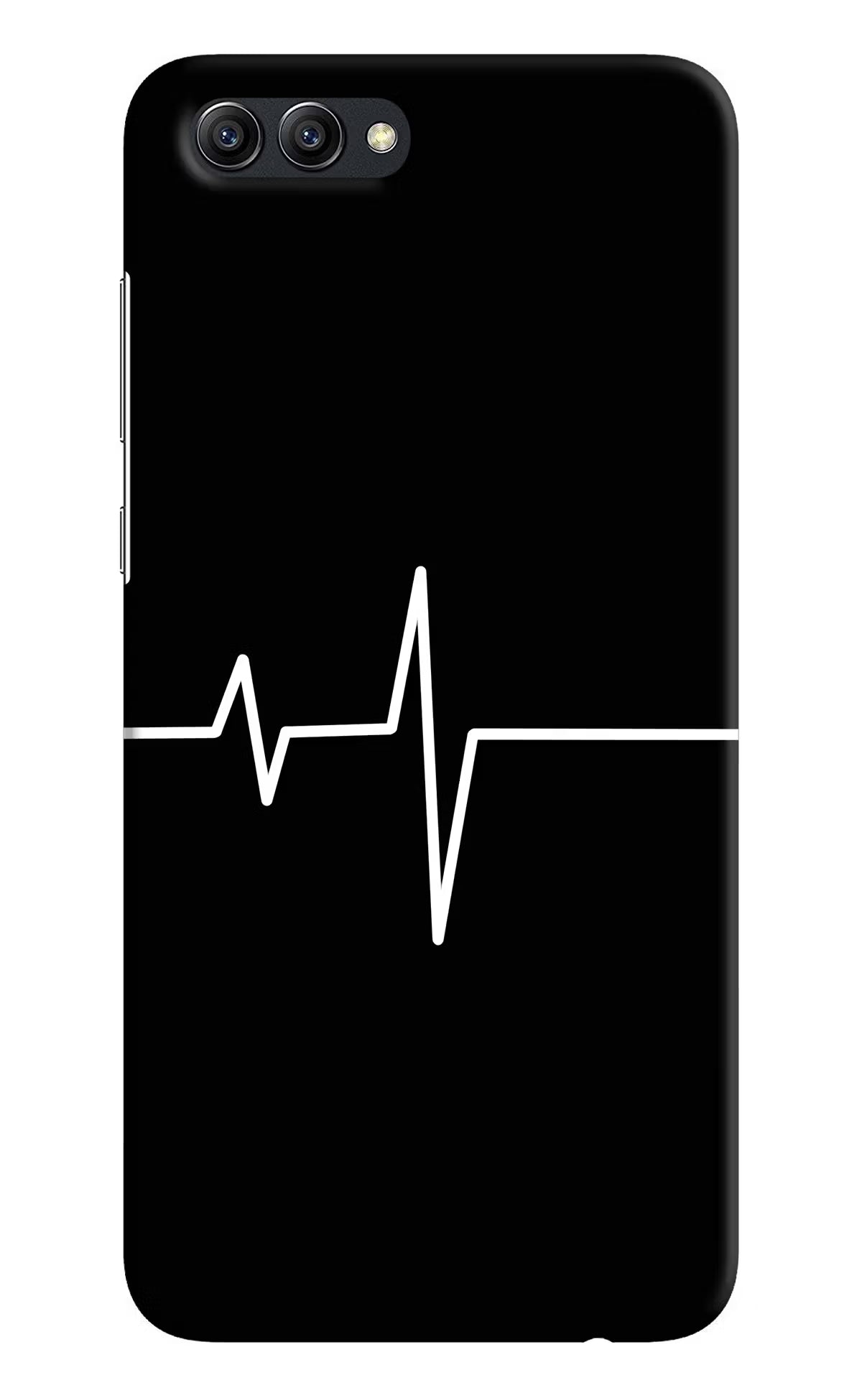 Heart Beats Honow View 10 Back Cover - Heart Beats Honow View 10 Hard Case Back Cover by Casekaro Heart Beats Honow View 10 Hard Case Back Cover by Casekaro