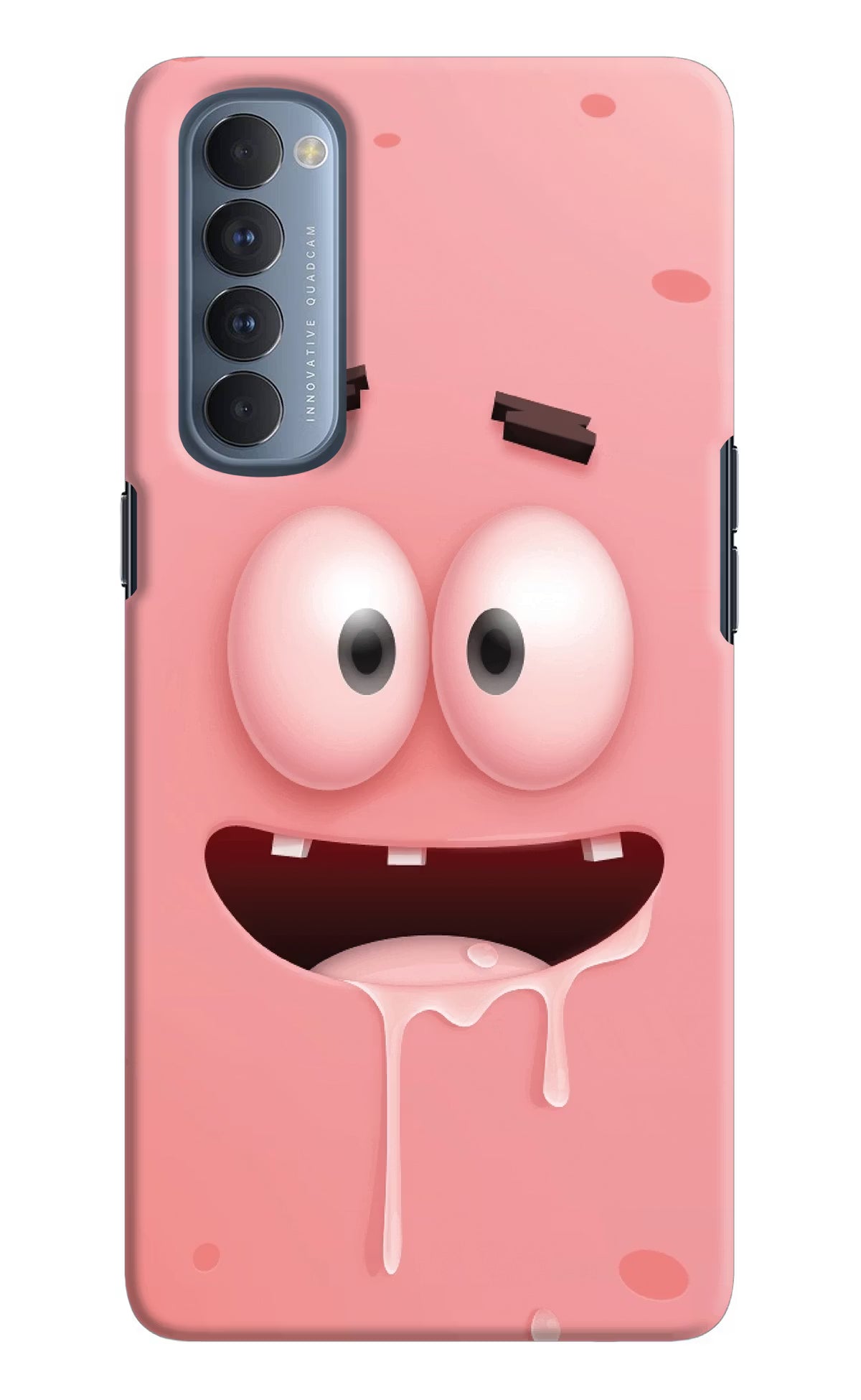 Sponge 2 Oppo Reno4 Pro Back Cover - Sponge 2 Oppo Reno4 Pro Hard Case Back Cover by Casekaro Sponge 2 Oppo Reno4 Pro Hard Case Back Cover by Casekaro