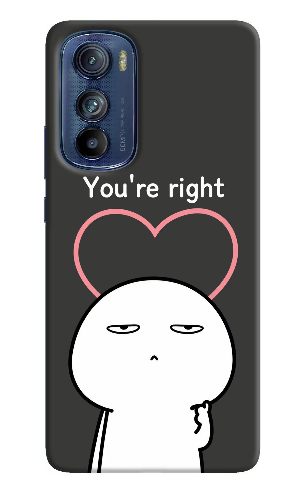 You're Right Moto Edge 30 Back Cover - You're Right Moto Edge 30 Back Cover You're Right Moto Edge 30 Back Cover