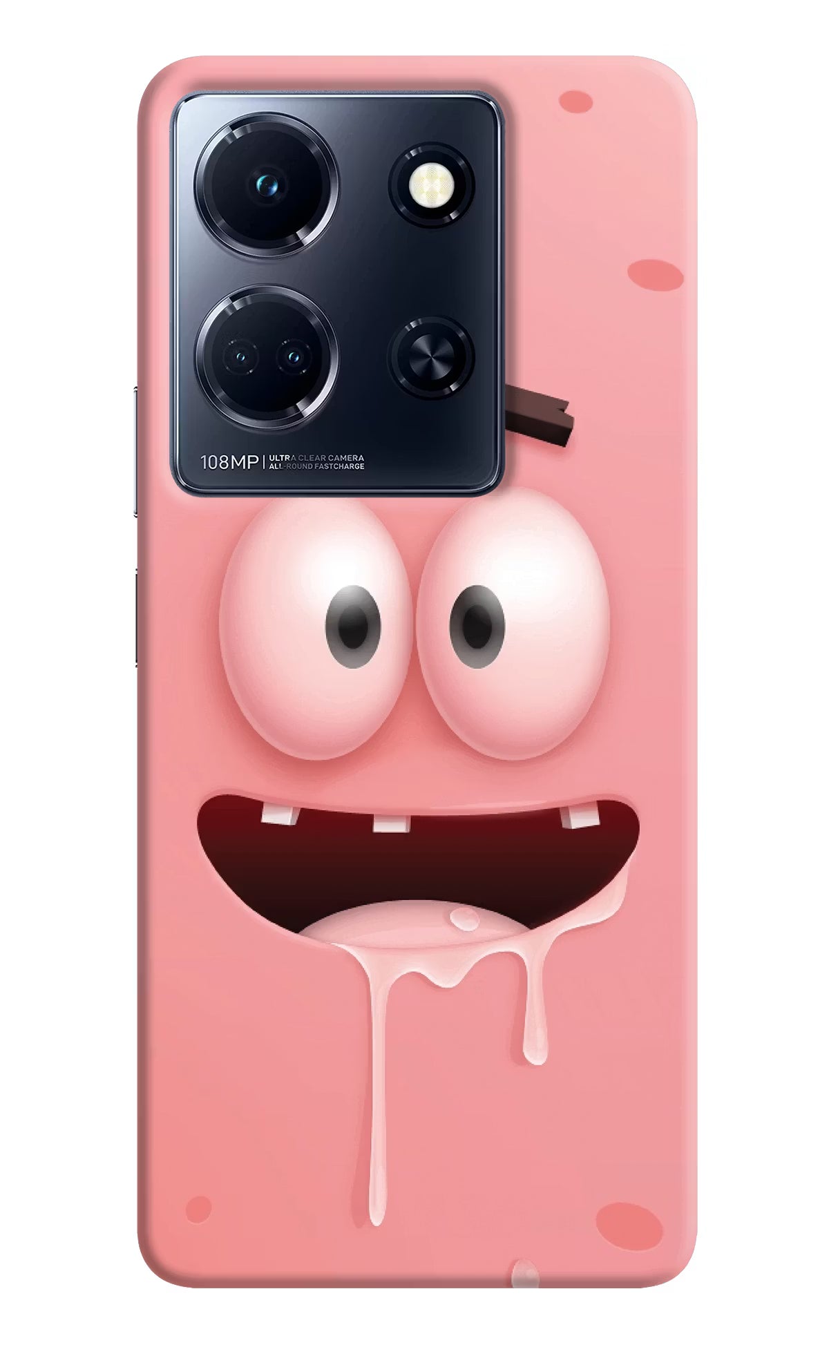 Sponge 2 Infinix Note 30 5g Hard Case Back Cover by Casekaro