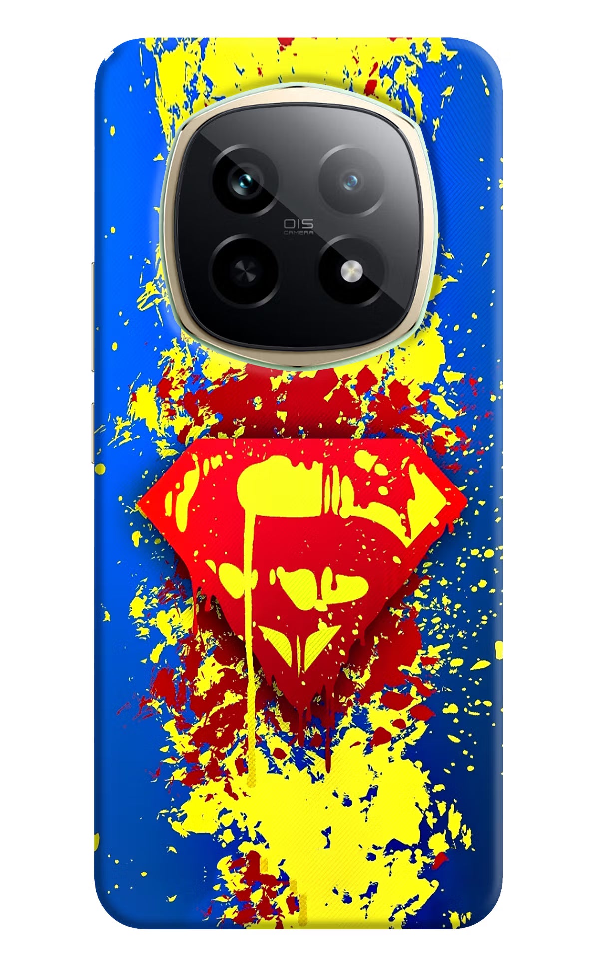 Superman logo Realme P2 Pro 5G Back Cover - Superman logo Realme P2 Pro 5G Hard Case Back Cover by Casekaro Superman logo Realme P2 Pro 5G Hard Case Back Cover by Casekaro