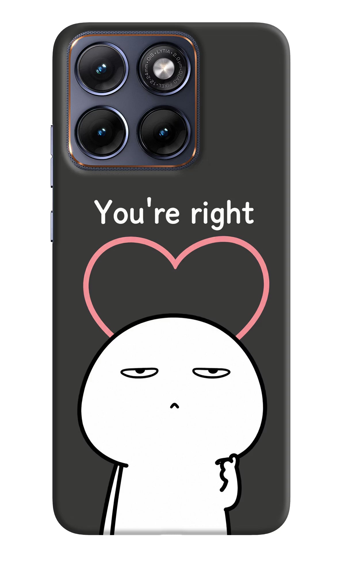 You're Right Moto Edge 70 Fusion Back Cover - You're Right Moto Edge 70 Fusion Back Cover You're Right Moto Edge 70 Fusion Back Cover