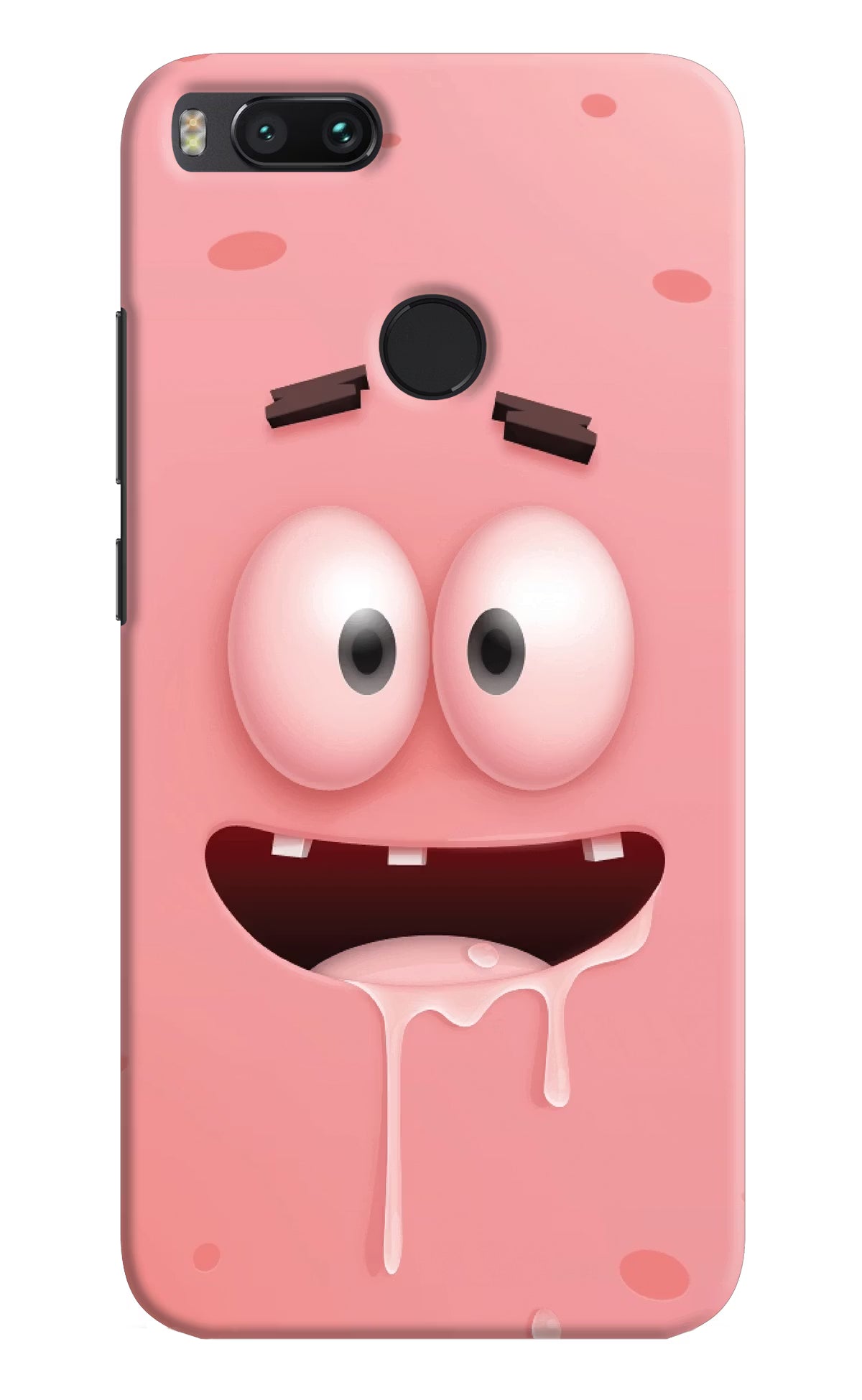 Sponge 2 Mi A1 Hard Case Back Cover by Casekaro