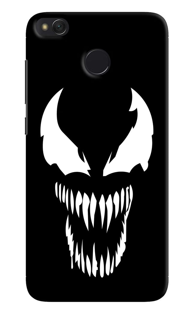 Venom Redmi 4 Hard Case Back Cover by Casekaro