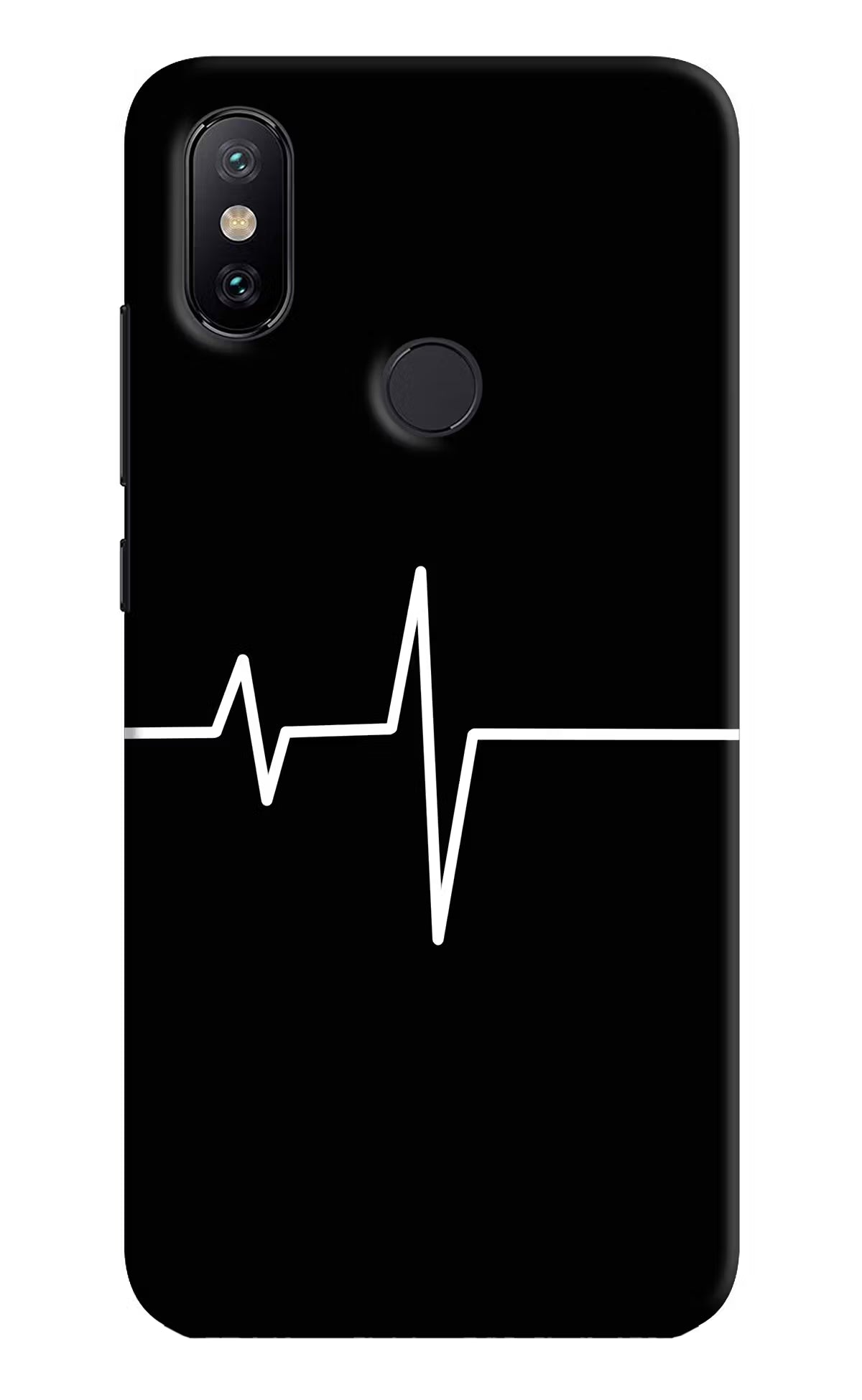 Heart Beats Mi A2 Hard Case Back Cover by Casekaro