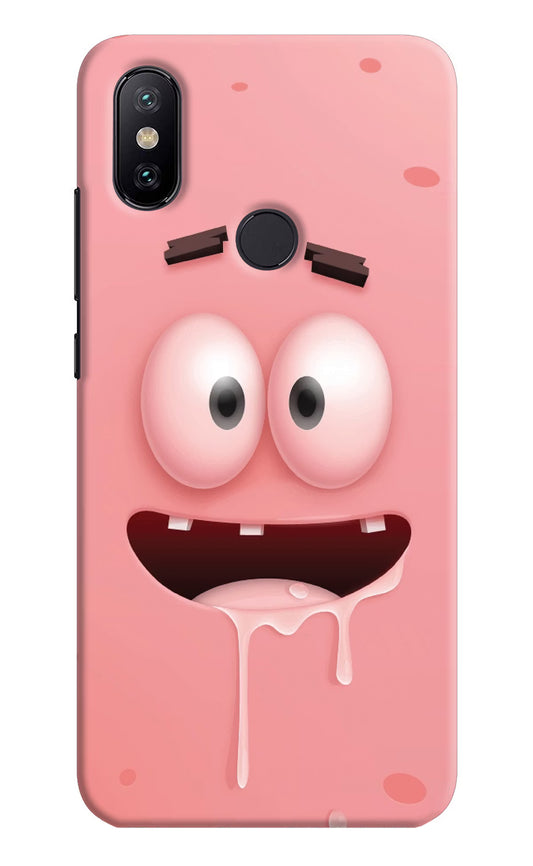 Sponge 2 Mi A2 Hard Case Back Cover by Casekaro