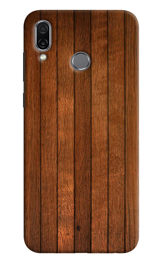 Wooden Artwork Bands Honor Play Hard Case Back Cover by Casekaro