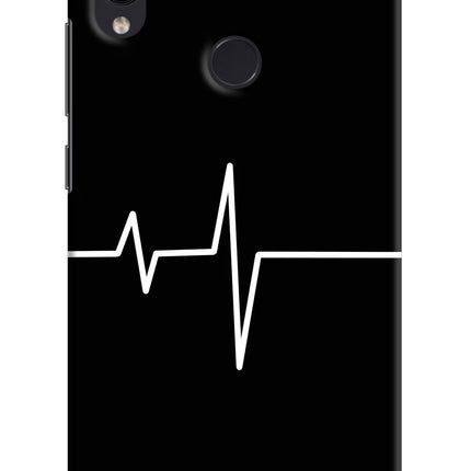Heart Beats Redmi Note 7/7S/7 Pro Hard Case Back Cover by Casekaro