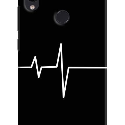 Heart Beats Redmi Note 7S Hard Case Back Cover by Casekaro