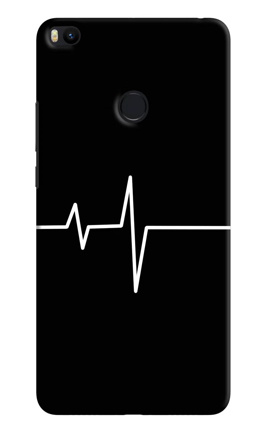 Heart Beats Mi Max 2 Back Cover, Hard case