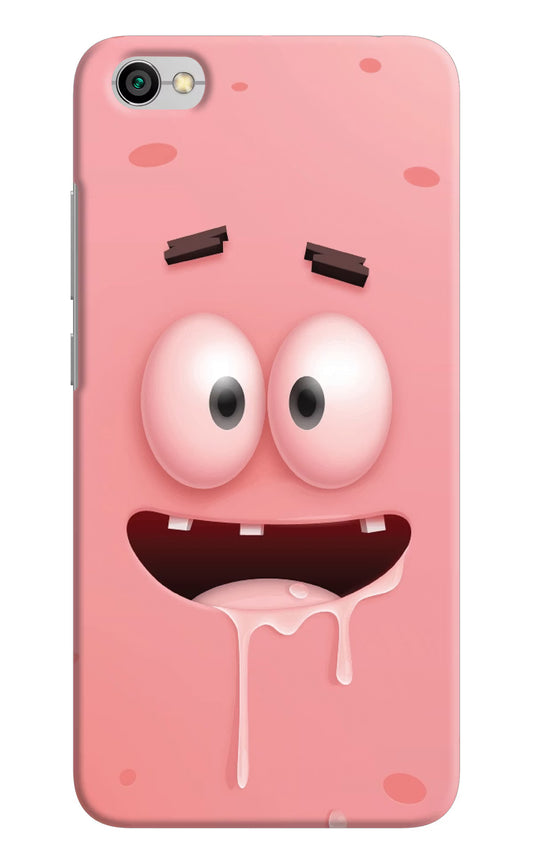 Sponge 2 Redmi Y1 Lite Hard Case Back Cover by Casekaro