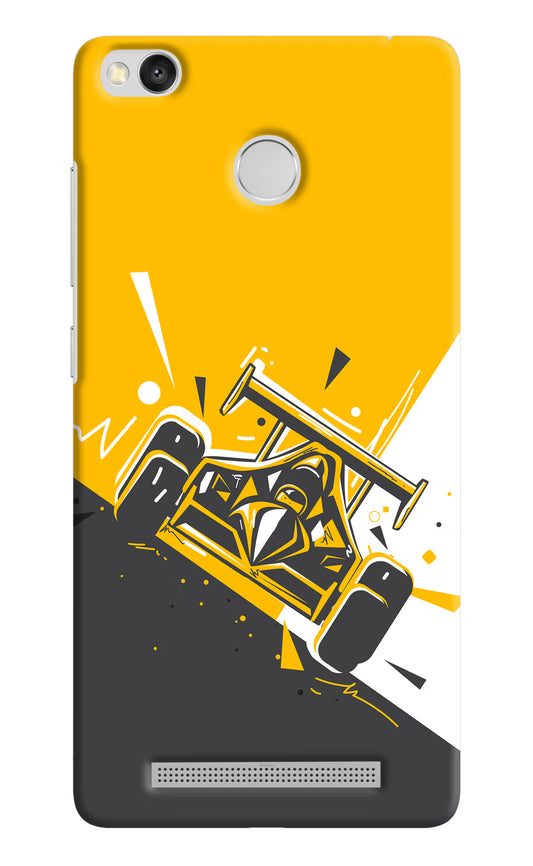 Track King Redmi 3S Prime Hard Case Back Cover by Casekaro