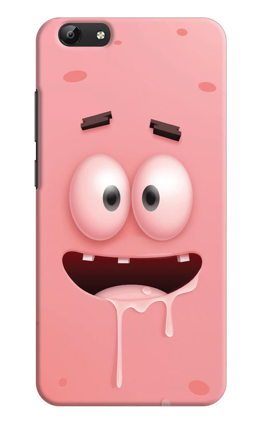 Sponge 2 Vivo Y69 Hard Case Back Cover by Casekaro