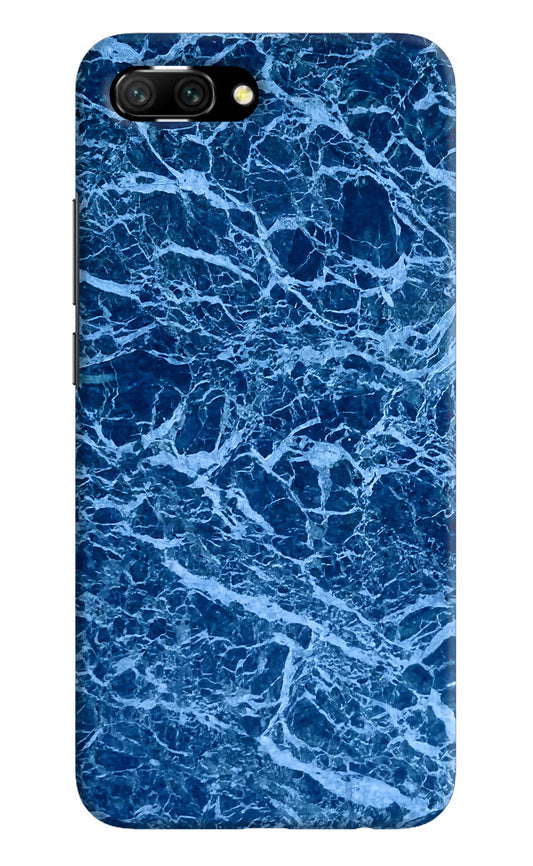 Blue Marble Honor 10 Hard Case Back Cover by Casekaro