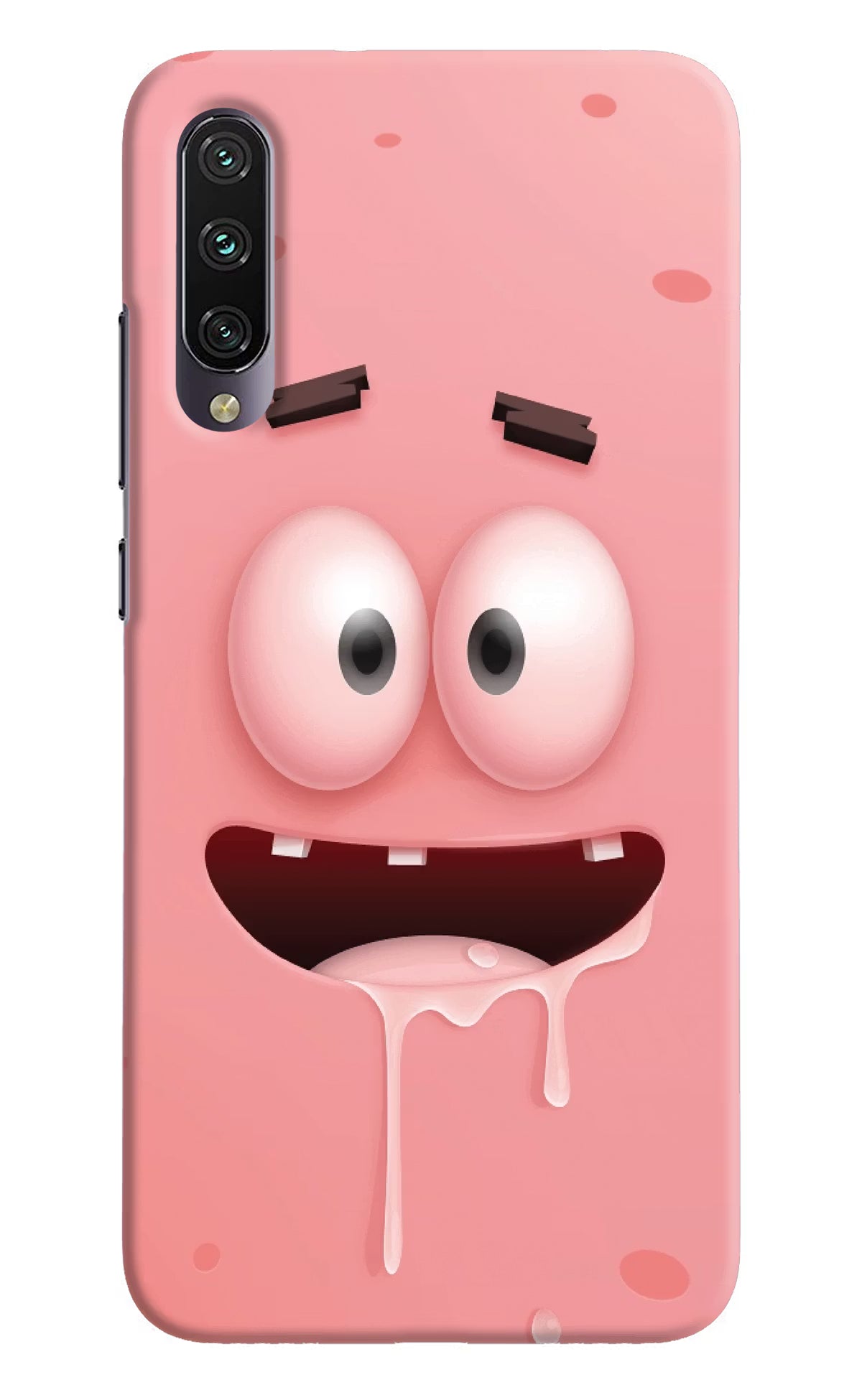 Sponge 2 Mi A3 Hard Case Back Cover by Casekaro