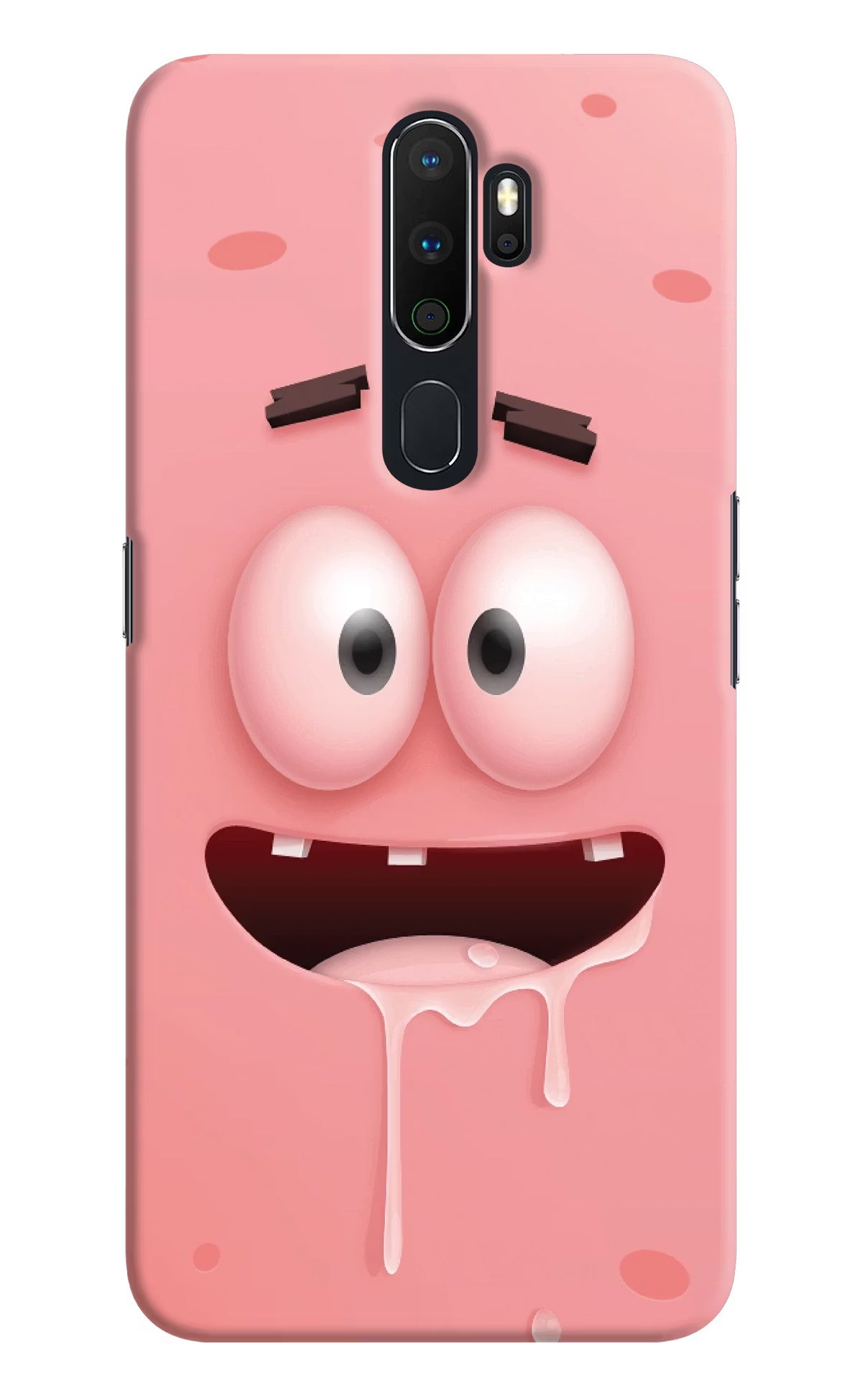 Sponge 2 Oppo A5 2020/A9 2020 Hard Case Back Cover by Casekaro