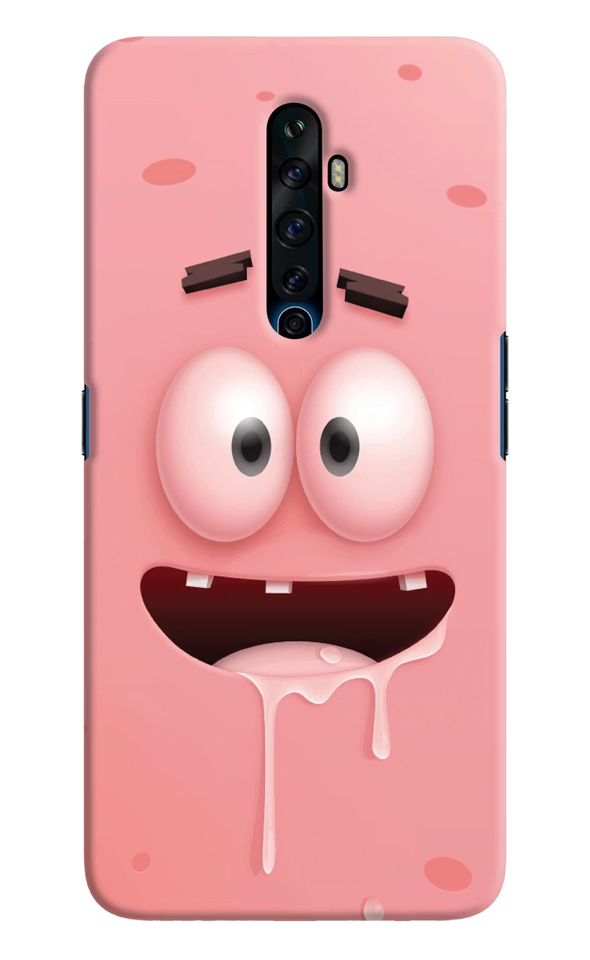 Sponge 2 Oppo Reno2 Z Hard Case Back Cover by Casekaro
