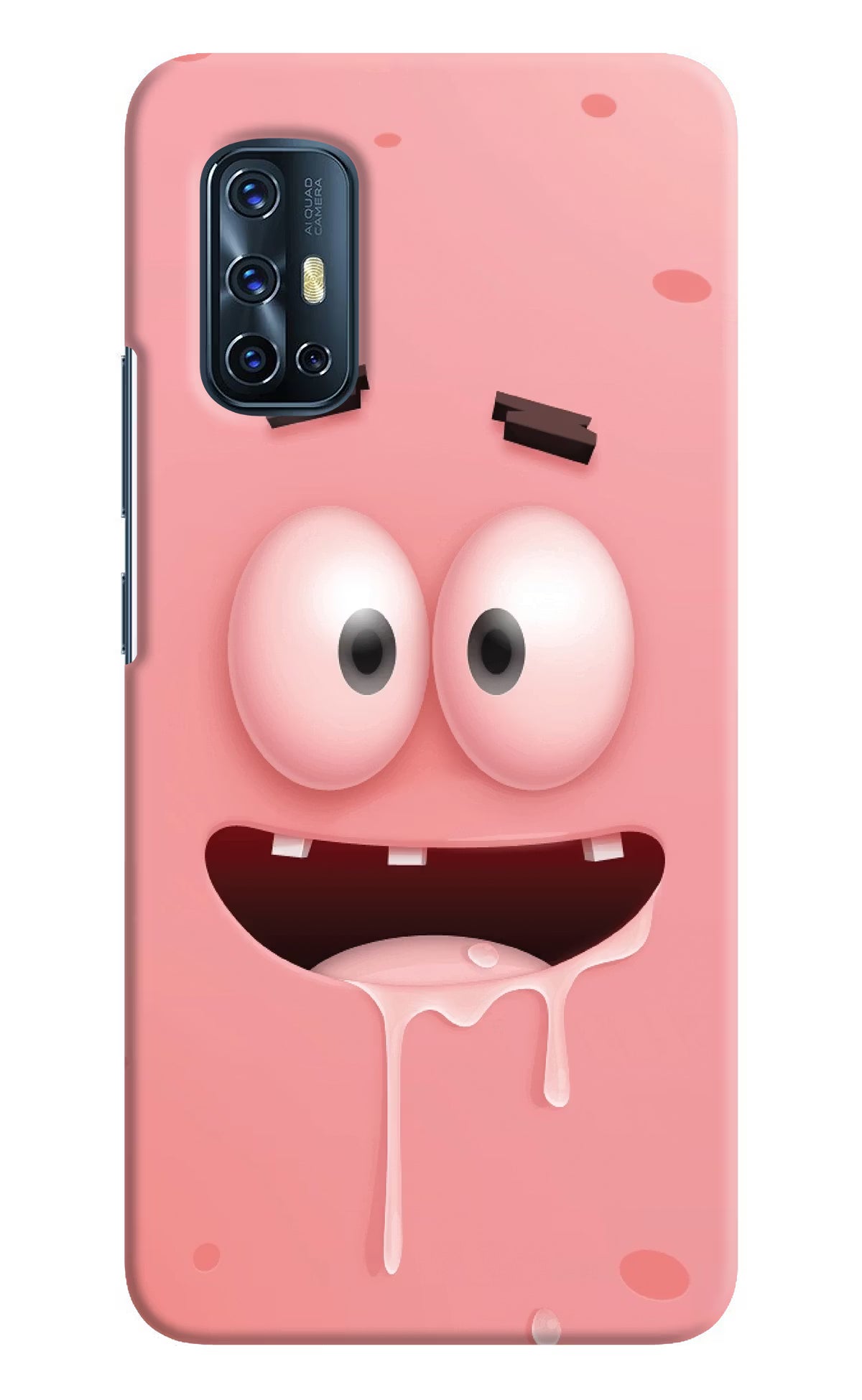 Sponge 2 Vivo V17 Hard Case Back Cover by Casekaro