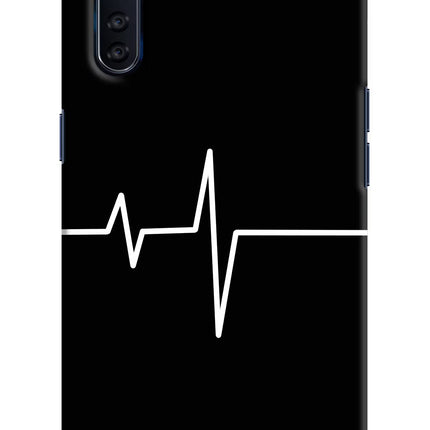 Heart Beats Oppo F15 Hard Case Back Cover by Casekaro
