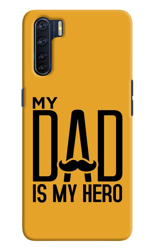 My Dad Is My Hero Oppo F15 Hard Case Back Cover by Casekaro
