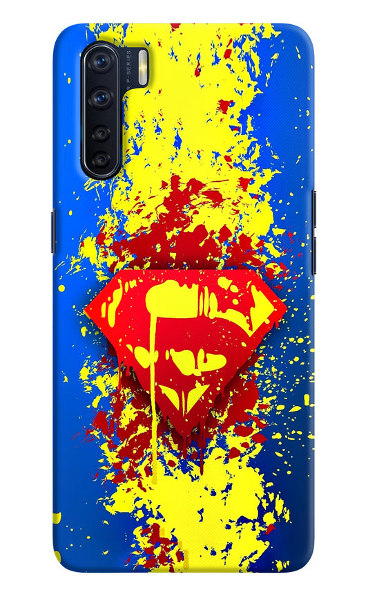 Superman logo Oppo F15 Hard Case Back Cover by Casekaro