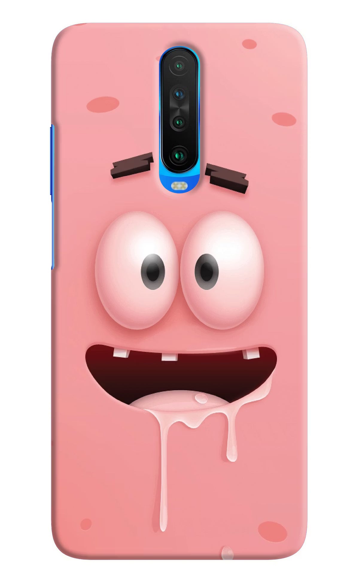 Sponge 2 Poco X2 Hard Case Back Cover by Casekaro
