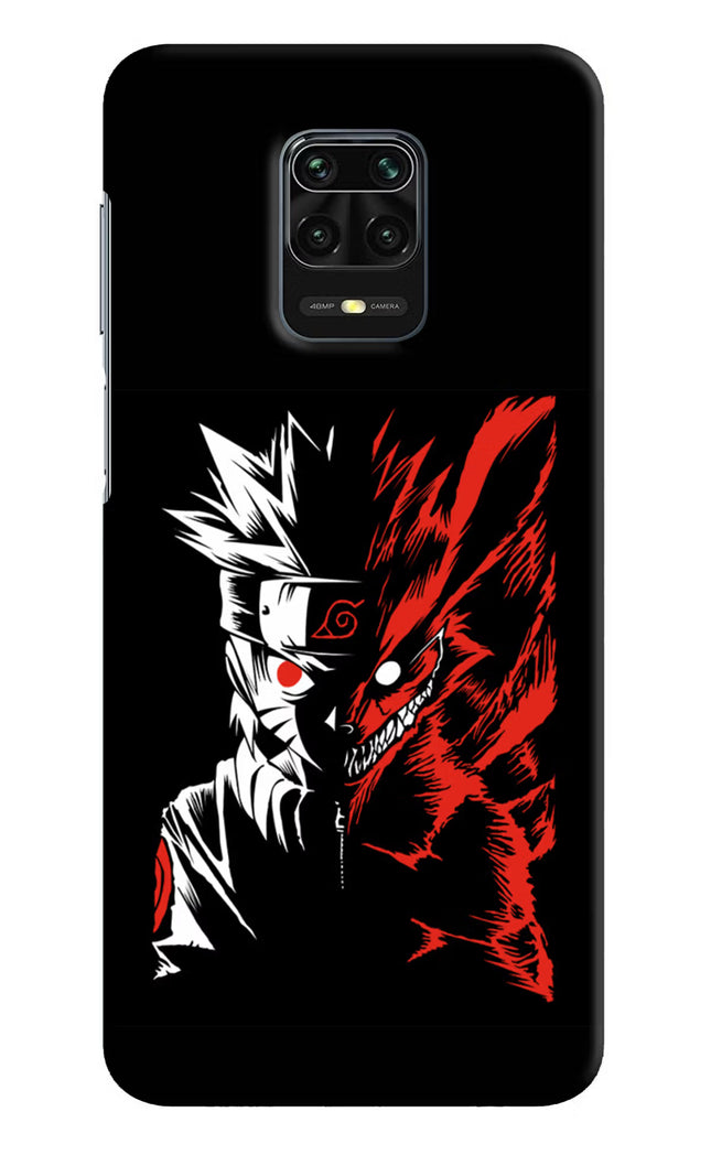 Naruto Two Face Redmi Note 9 Pro/Pro Max Hard Case Back Cover by Casekaro