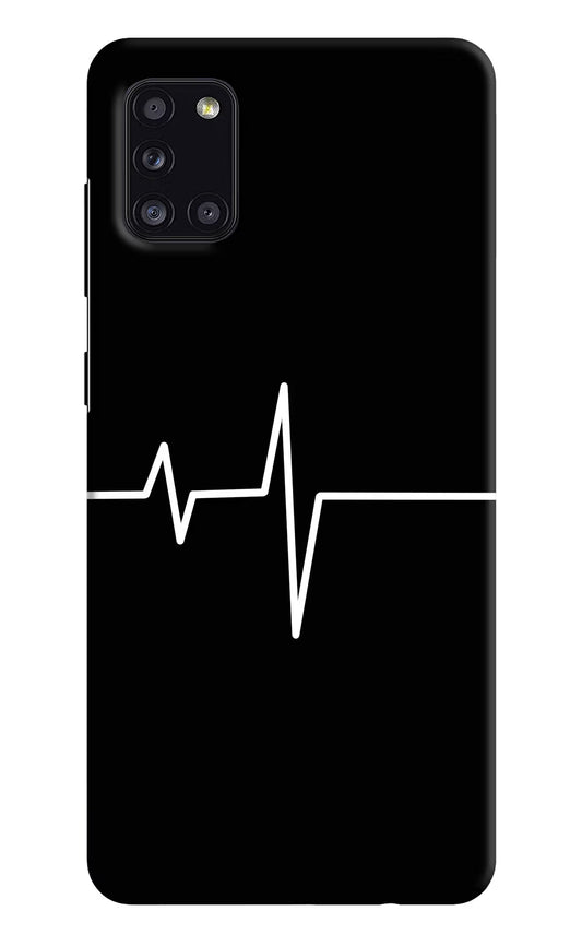 Heart Beats Samsung A31 Hard Case Back Cover by Casekaro