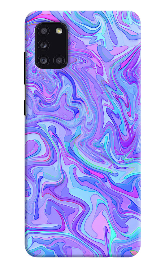 Glitter Samsung A31 Hard Case Back Cover by Casekaro