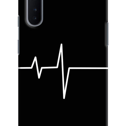 Heart Beats Oneplus Nord Hard Case Back Cover by Casekaro