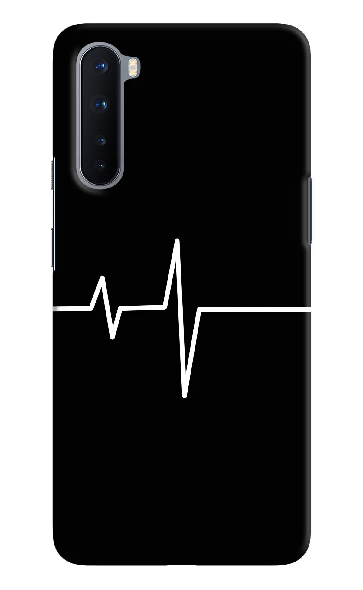 Heart Beats Oneplus Nord Hard Case Back Cover by Casekaro
