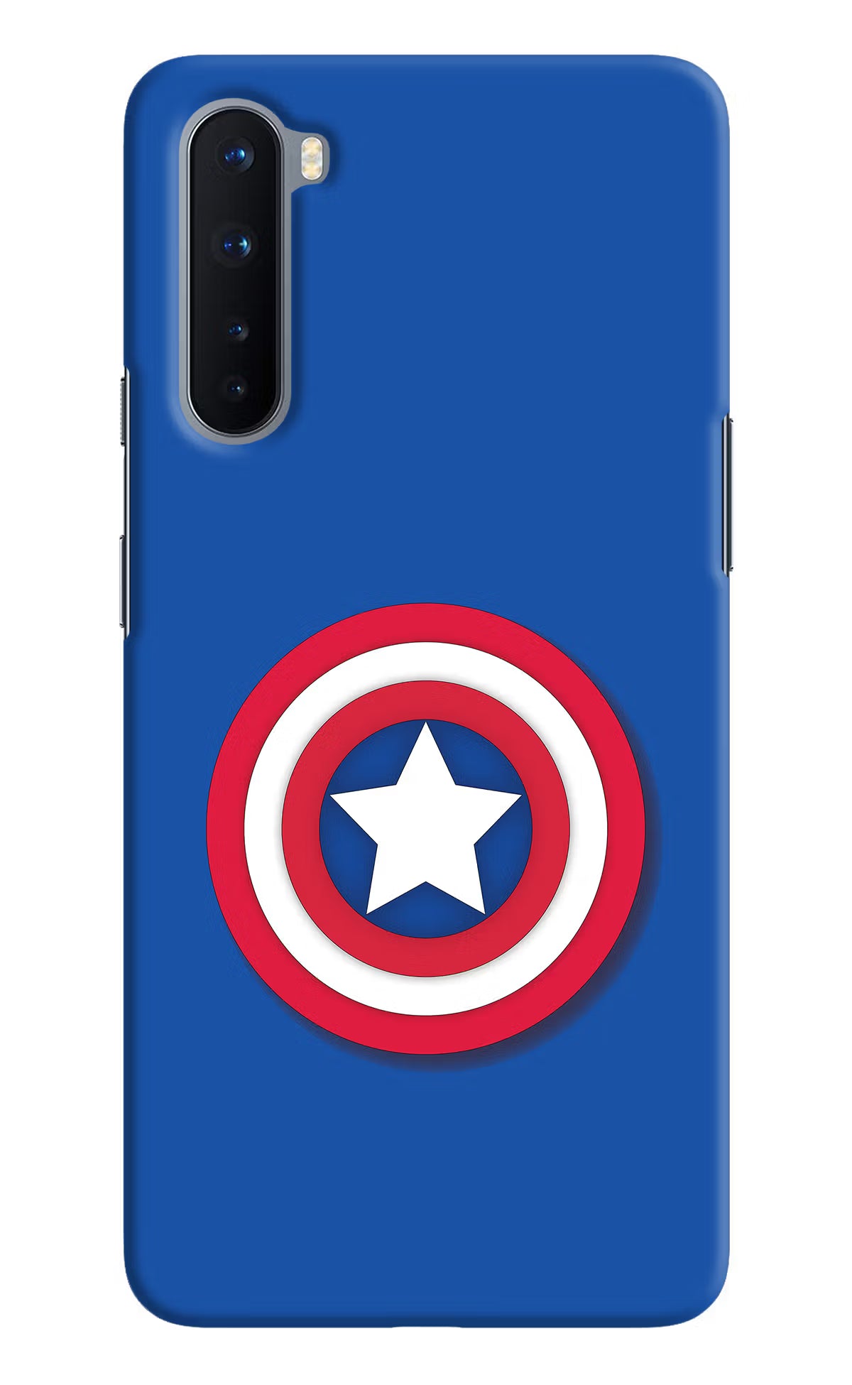 Shield Oneplus Nord Hard Case Back Cover by Casekaro