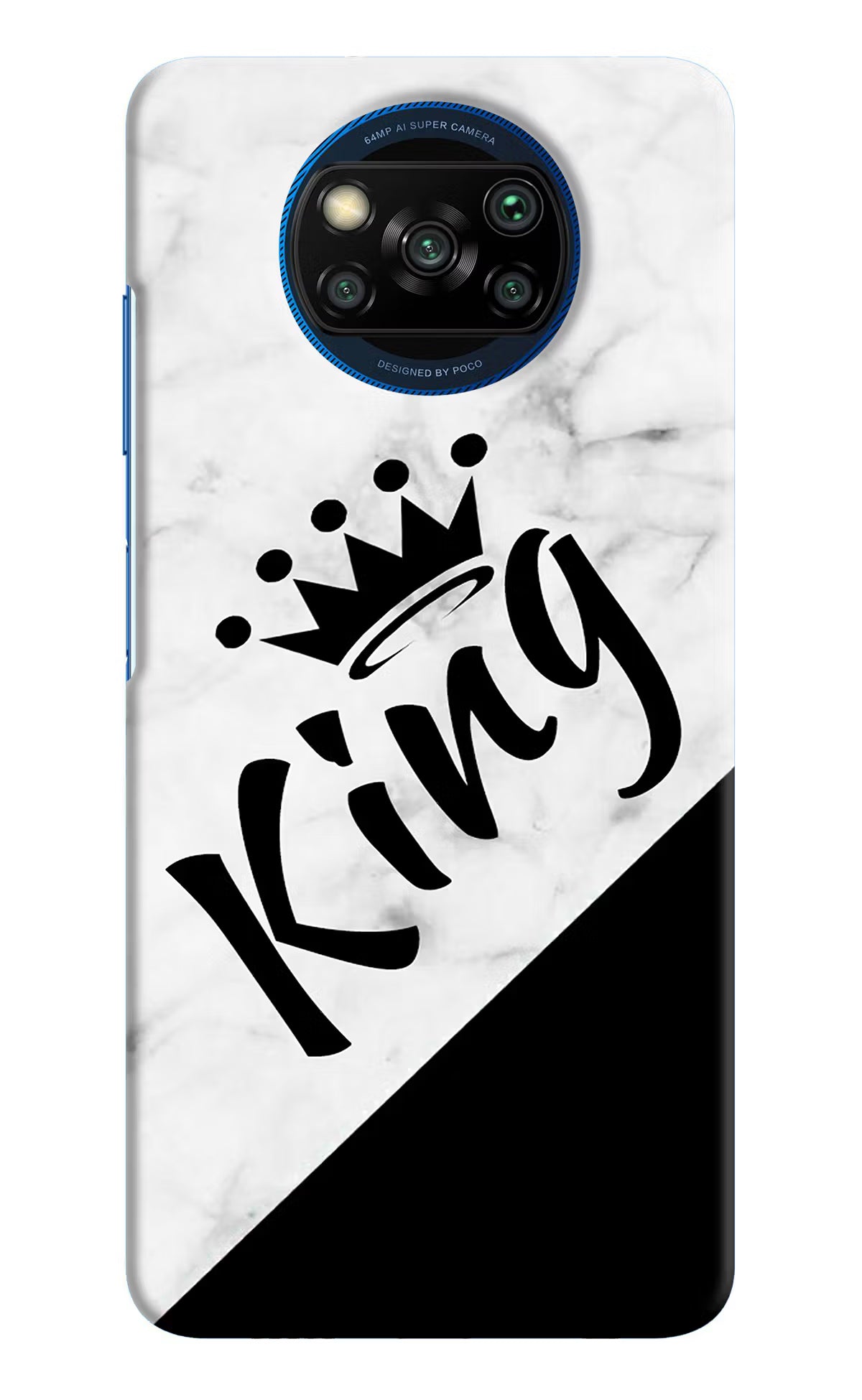 King Poco X3/X3 Pro Hard Case Back Cover by Casekaro