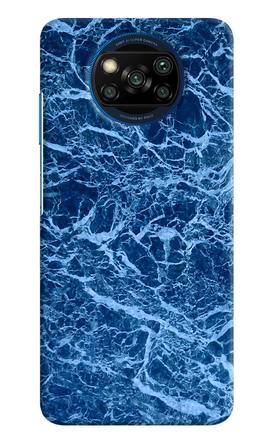 Blue Marble Poco X3/X3 Pro Hard Case Back Cover by Casekaro