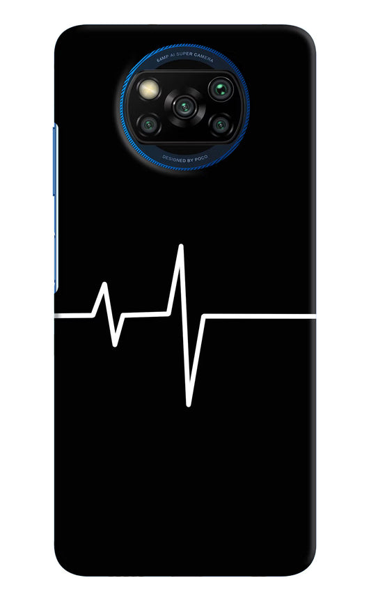 Heart Beats Poco X3/X3 Pro Hard Case Back Cover by Casekaro
