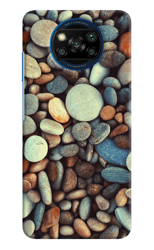 Pebble Poco X3/X3 Pro Hard Case Back Cover by Casekaro
