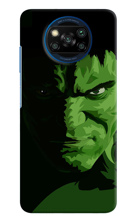 HULK Poco X3/X3 Pro Hard Case Back Cover by Casekaro