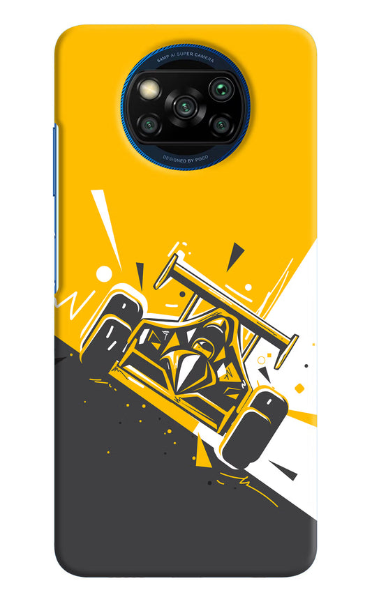 Track King Poco X3/X3 Pro Hard Case Back Cover by Casekaro
