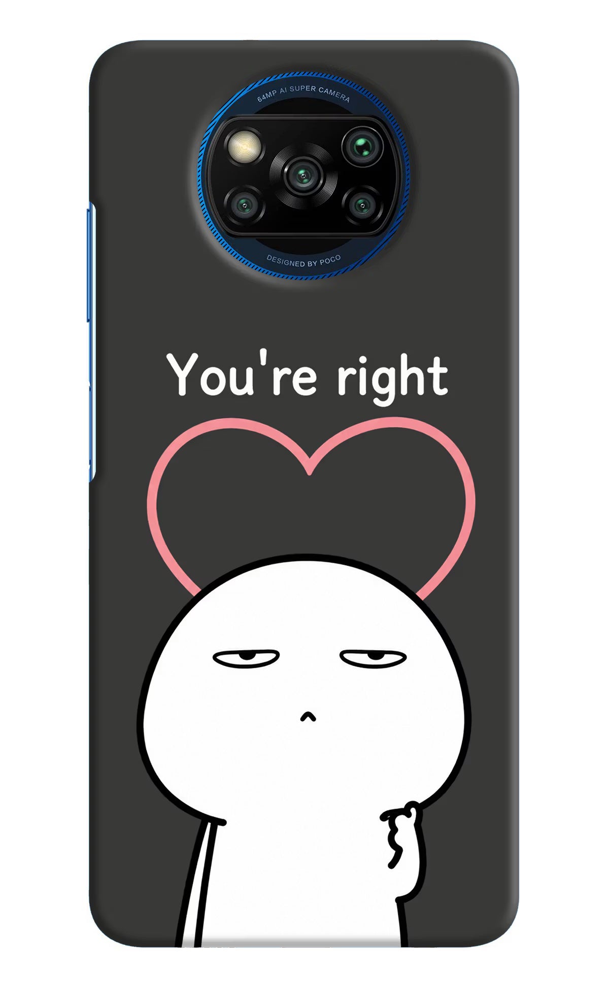 You're Right Poco X3/X3 Pro Back Cover