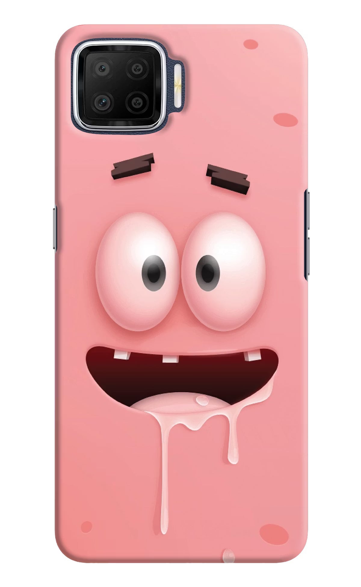 Sponge 2 Oppo F17 Hard Case Back Cover by Casekaro