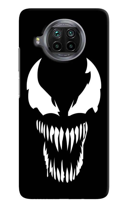 Venom Mi 10i Hard Case Back Cover by Casekaro