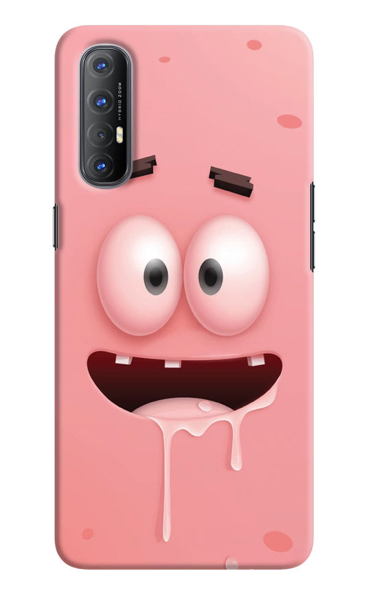 Sponge 2 Oppo Reno3 Pro Hard Case Back Cover by Casekaro