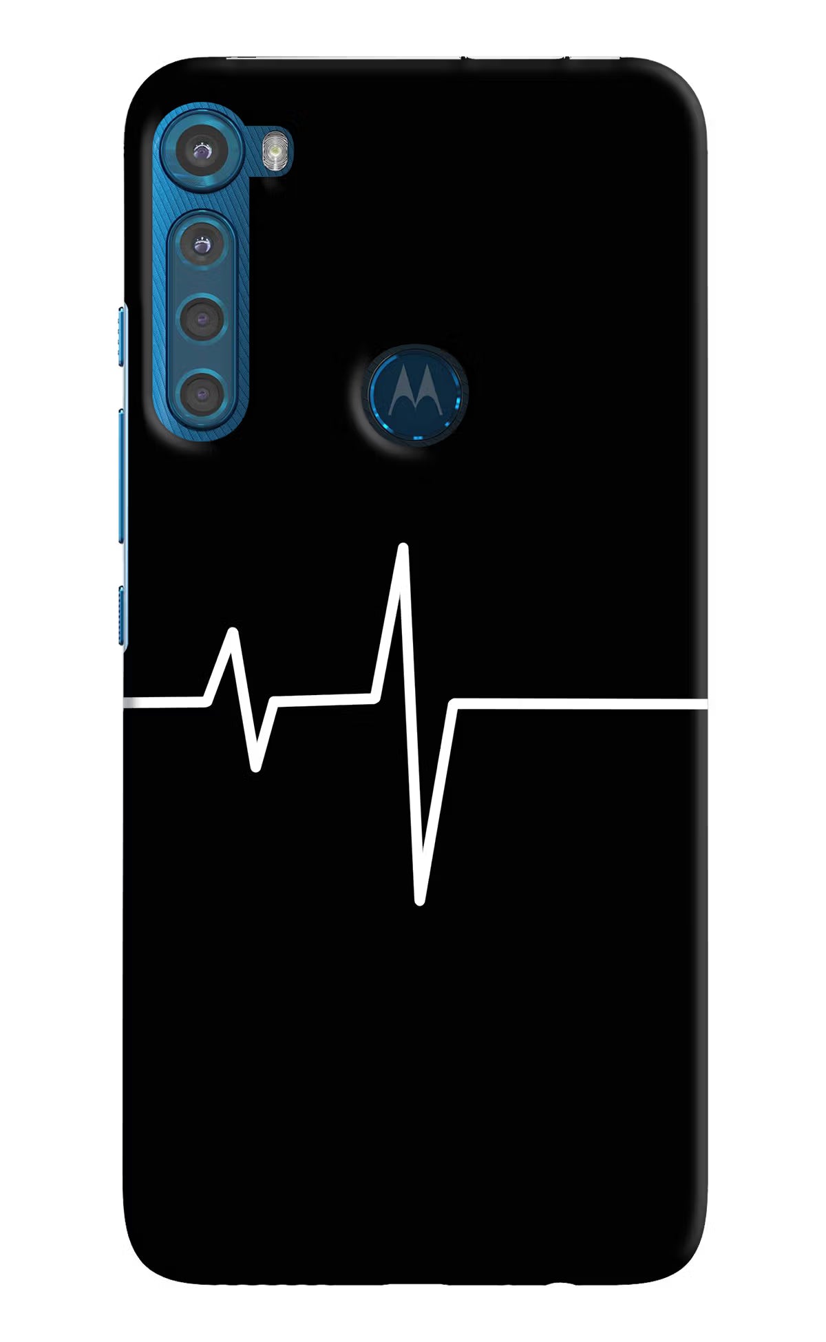 Heart Beats Motorola One Fusion Plus Hard Case Back Cover by Casekaro