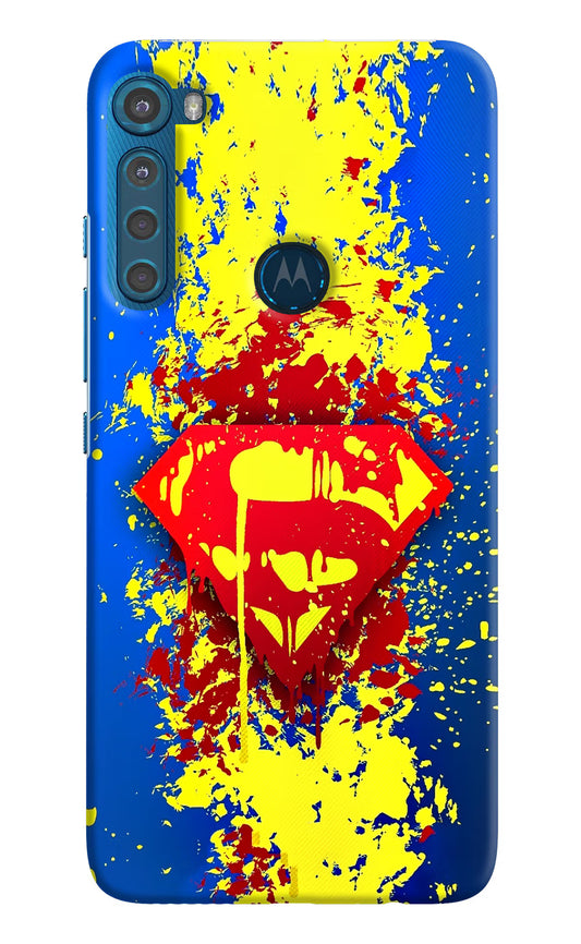 Superman logo Motorola One Fusion Plus Hard Case Back Cover by Casekaro