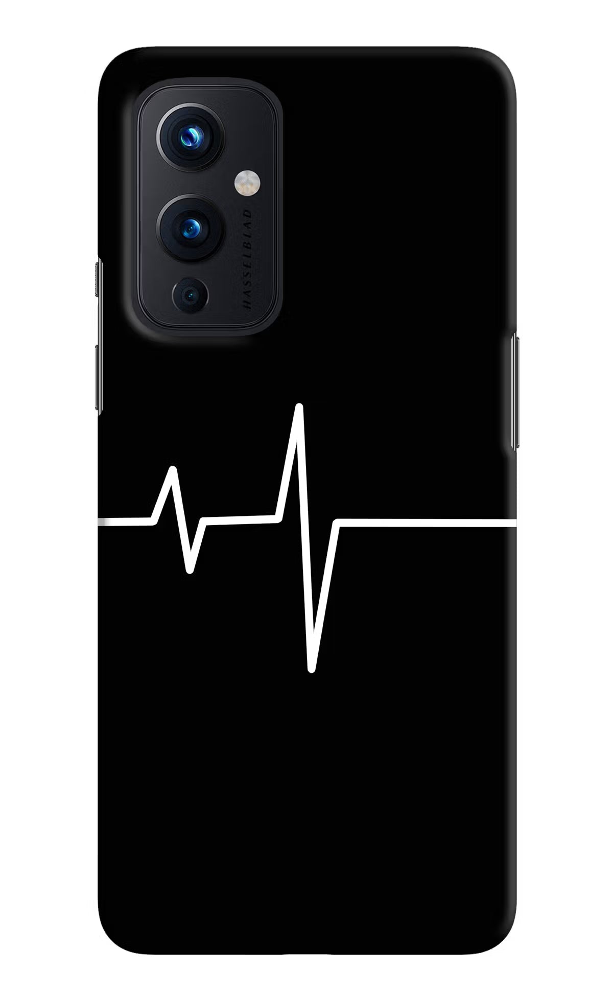 Heart Beats Oneplus 9 Hard Case Back Cover by Casekaro