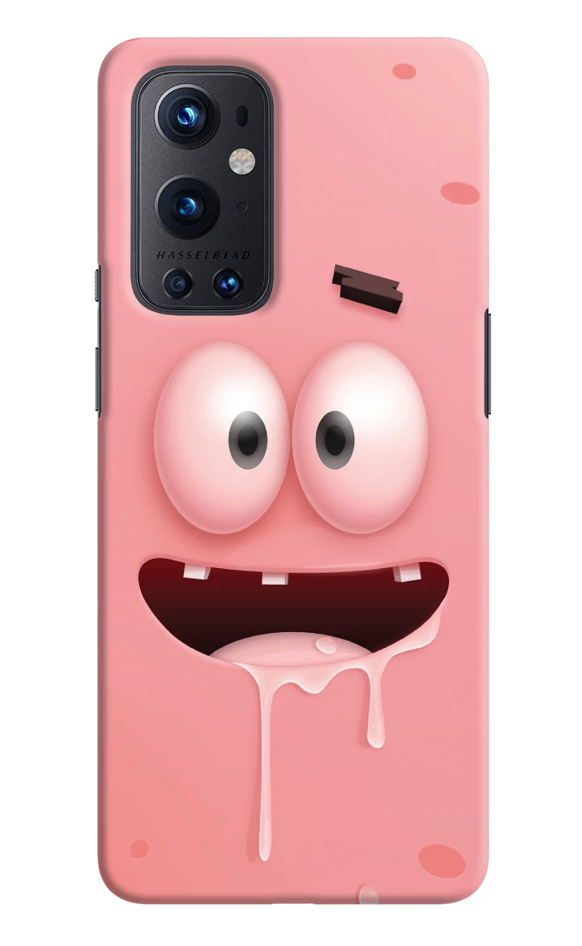 Sponge 2 Oneplus 9 Pro Hard Case Back Cover by Casekaro