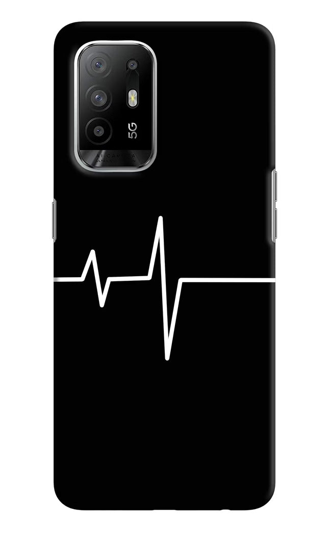 Heart Beats Oppo F19 Pro+ Hard Case Back Cover by Casekaro