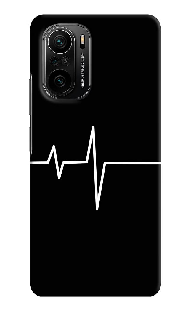 Heart Beats Mi 11X/11X Pro Hard Case Back Cover by Casekaro