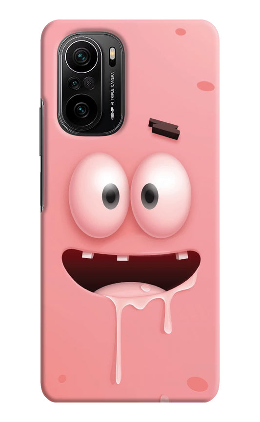 Sponge 2 Mi 11X/11X Pro Hard Case Back Cover by Casekaro